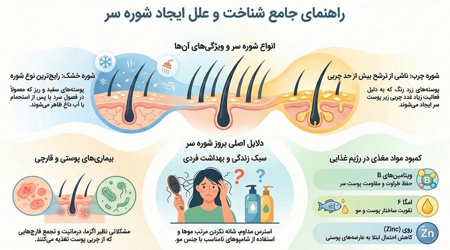 علت به وجود آمدن شوره سر