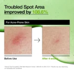 سرم ضدلک آنوا Azelaic Acid 10 - تصویر 4