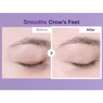 دورچشم ضدچروک و تیرگی نامبوزین شماره 9 Volumetox - تصویر 5