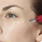 كرم دور چشم ضدچروک لورال REVITALIFT LASER - تصویر 2