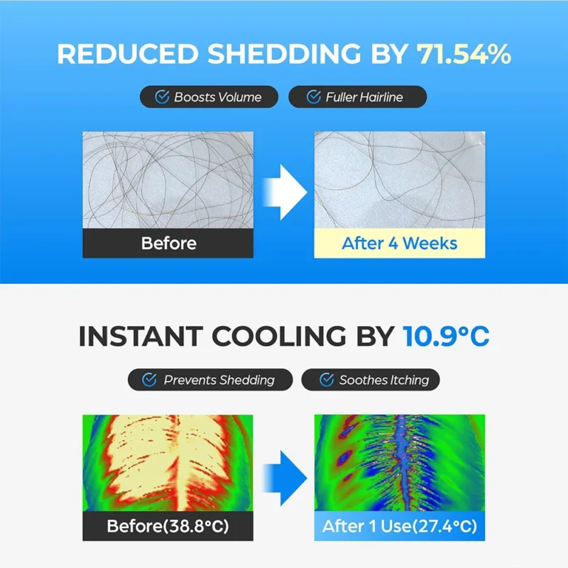سرم ضدریزش و تقویت ریشه مو سی پوری SCALPY HAIR - Image 5