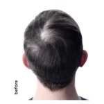 پودر حجمدهنده مو تاپیک Hair Building - Image 4