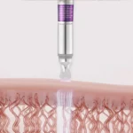 دورچشم لیفتینگ و ضدچروک ویتی Reedle Shot حجم 15میل - Image 5