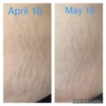 روغن صورت و بدن بایو اویل Skincare Oil حجم 60 میل - Image 5