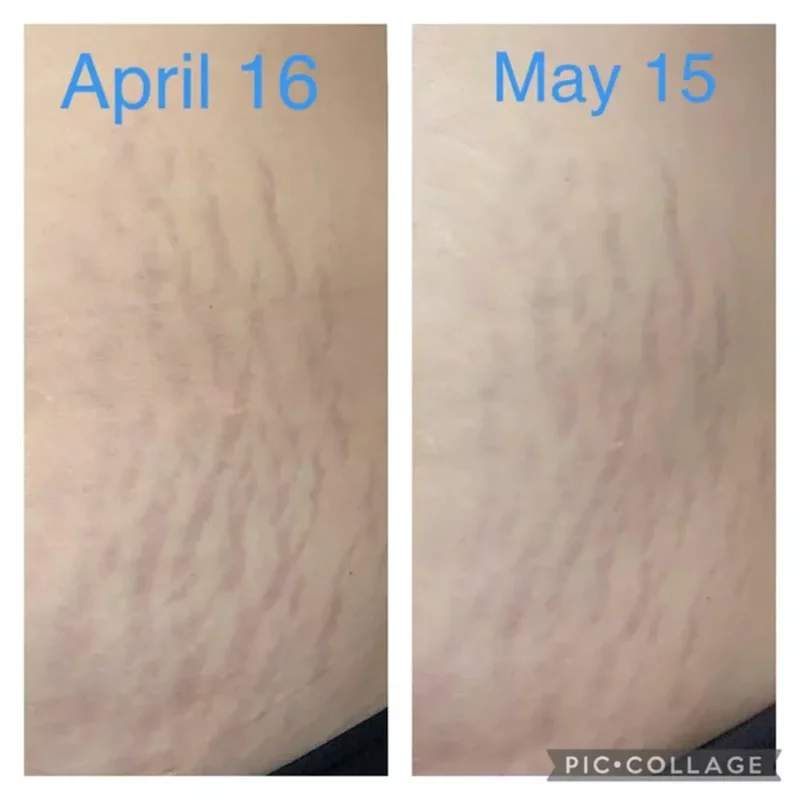 روغن صورت و بدن بایو اویل Skincare Oil حجم 60 میل - Image 5