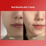 دستگاه لیفتینگ و سفت‌کننده مدی‌تراپی EMS Device - Image 8