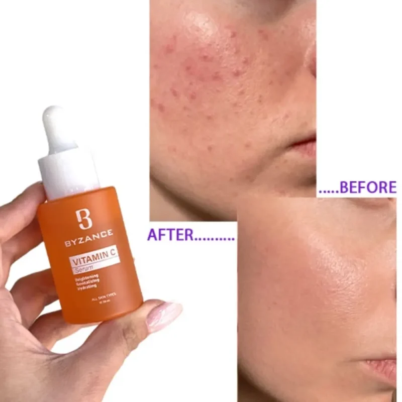 سرم ویتامین C بیزانس حجم ۳۰ میل - Image 3