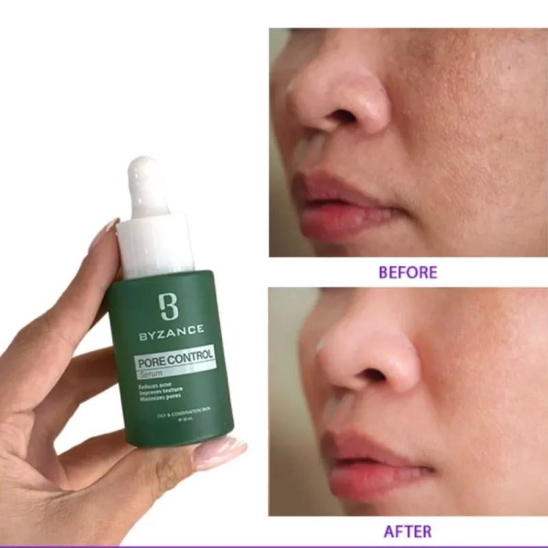 سرم کوچک کننده منافذ بیزانس حجم 30 میل - Image 3