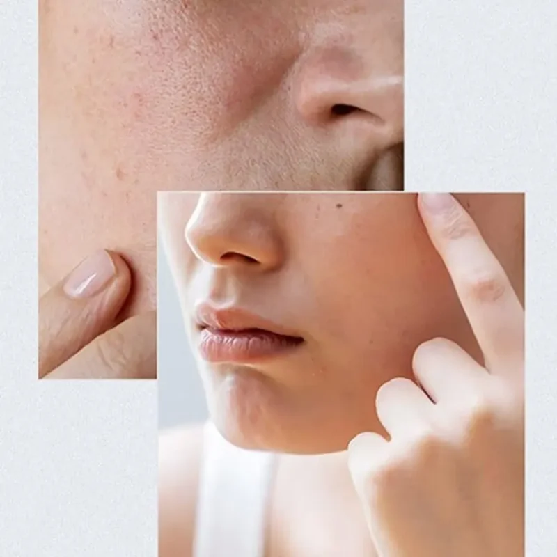 سرم آبرسان آنوا Birch 70 + Hyaluron حجم ۳۰ میل - Image 6