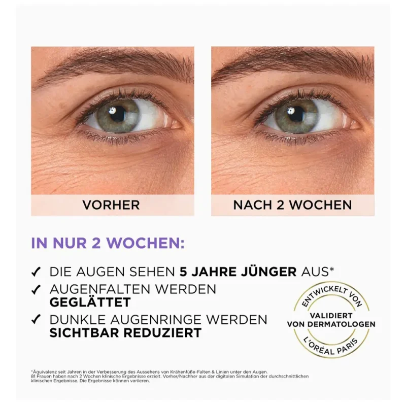 سرم دور چشم لورآل  Revitalift Filler حجم ۲۰ میل - Image 3