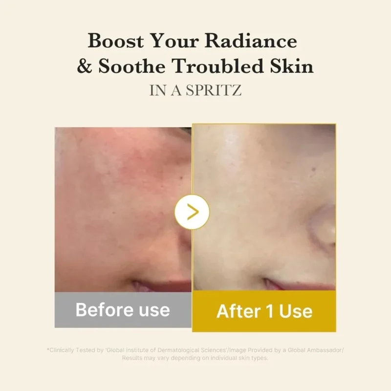 سرم میست مدیکیوب Kojic Acid Turmeric Vita - Image 7