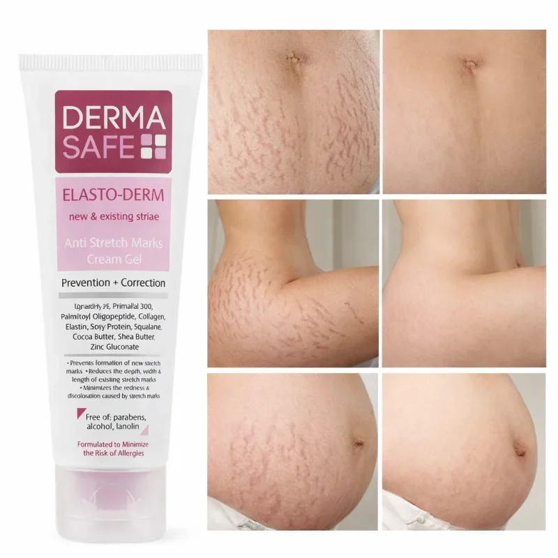 کرم ژل ضد ترک پوستی درماسیف ELASTO-DERM حجم 75گرم - Image 2