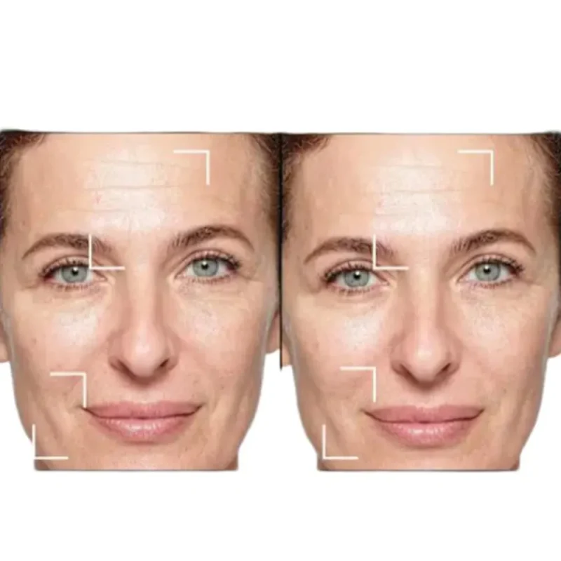 کرم روز لیفت کننده لورآل Golden Age حجم ۵۰ میل - Image 2