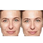 کرم شب لیفت کننده لورآل Age Perfect حجم ۵۰ میل - Image 3