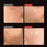 کرم روشن کننده دکتر ملاکسین حجم ۵۰ میل - Image 4