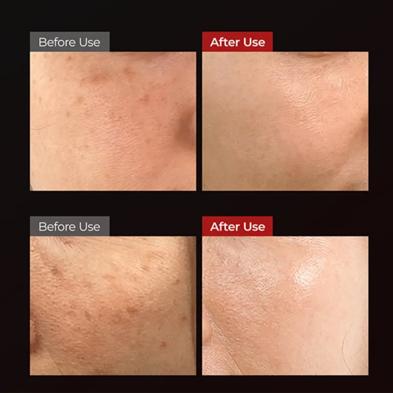 کرم روشن کننده دکتر ملاکسین حجم ۵۰ میل - Image 4