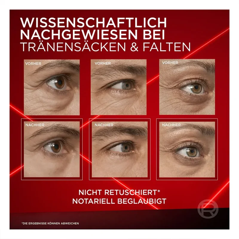 کرم دور چشم لورآل Revitalift Laser حجم ۱۵ میل - Image 5