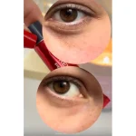 کرم دور چشم لورآل Revitalift Laser حجم ۱۵ میل - Image 4