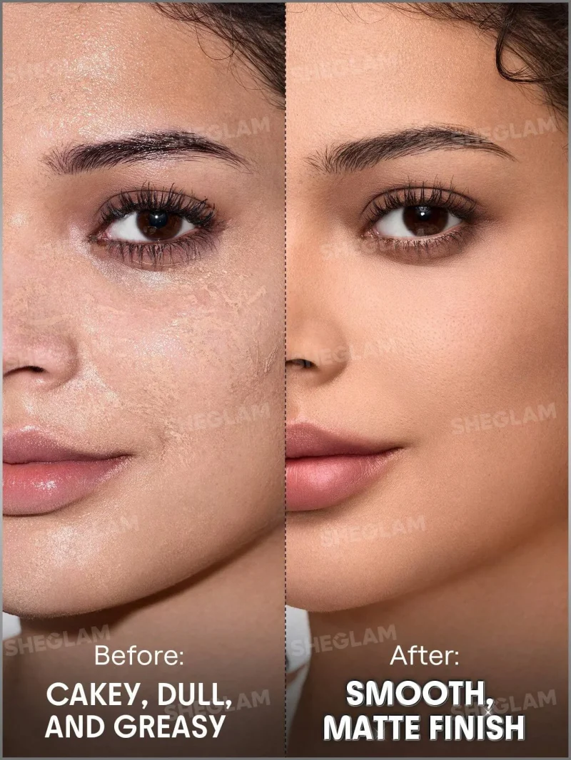 اسپری فیکس شیگلم