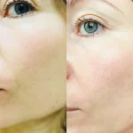 ژل شستشو صورت پوست خشک و حساس بایودرما مدل Sensibio حجم 200میل - Image 3