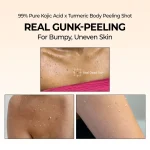 اسپری لایه بردار بدن دکتر ملاکسین Exfoliating Kojic acid حجم 200میل - Image 3