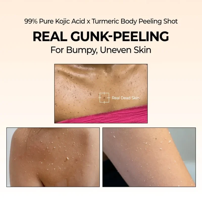 اسپری لایه بردار بدن دکتر ملاکسین Exfoliating Kojic acid حجم 200میل - Image 3