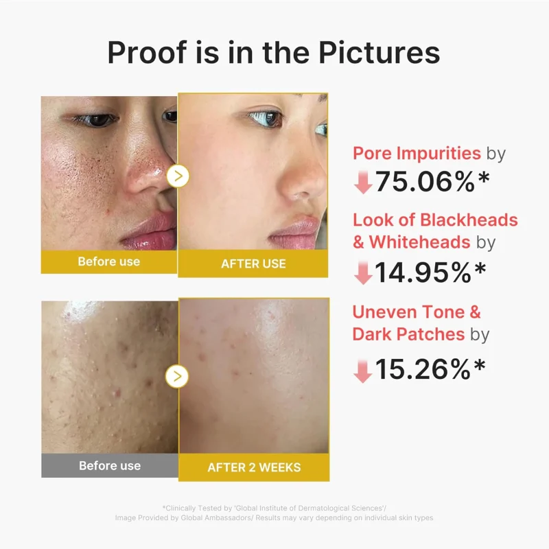 سرم لایه‌بردار مدیکوب مدل Kojic Acid Turmeric Peel Shot حجم 80 میلی‌لیتر