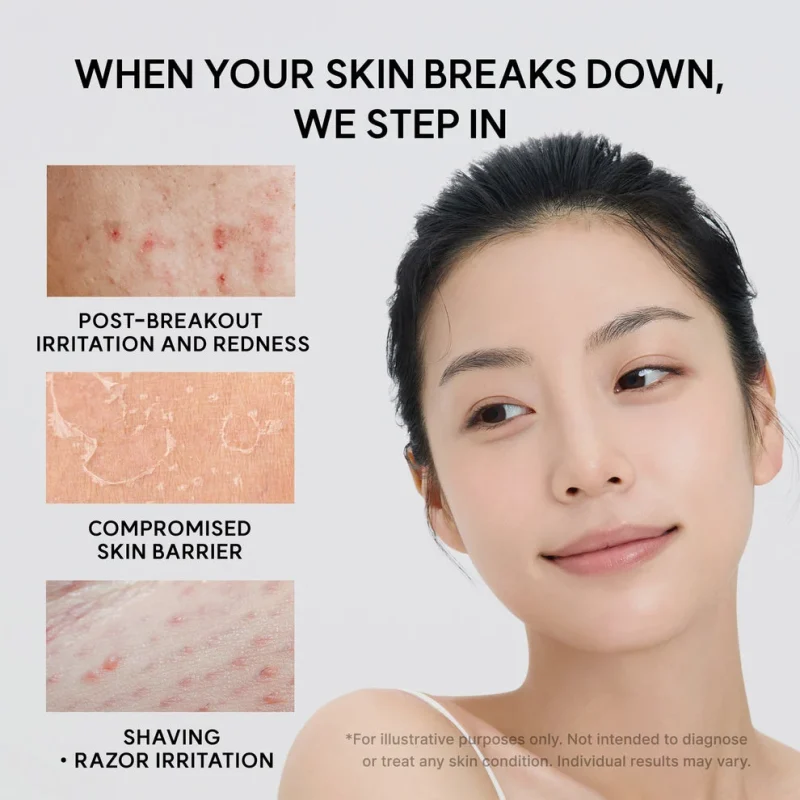 کرم مرطوب کننده صورت آرنسیا مدل Eraser Soothing Cream حجم 50 میلی‌لیتر